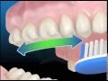 Cepillado dental - Galindo Dentistas | Clinica Dental en Málaga