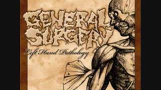 Watch General Surgery Convivial Corpse Disposal Methodology video