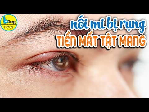 Nối mi giả rụng mi thật, chị em phải làm gì?