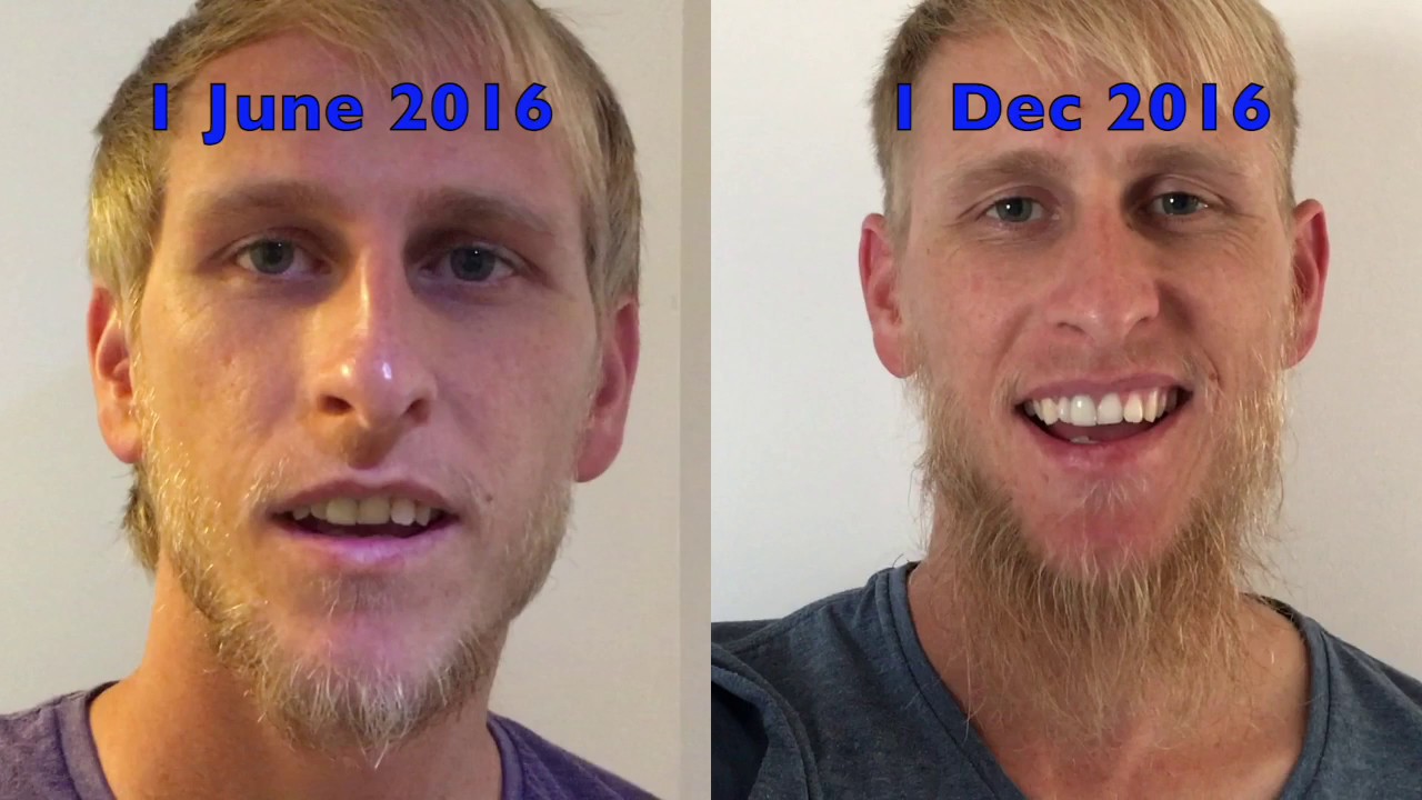 Facial hair growing enhancement