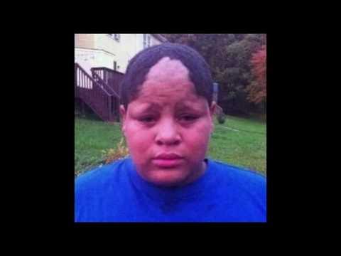 Funny Hairline Fails Funny Hairline Fails
