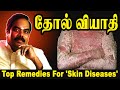 How To Get Rid of "Skin Diseases" Naturally ? ~ Amazing Skin Care Tips ~ Simple Home Remedies !