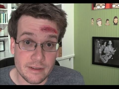 concussed-question-friday.html