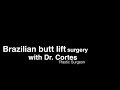 brazil plastic surgery