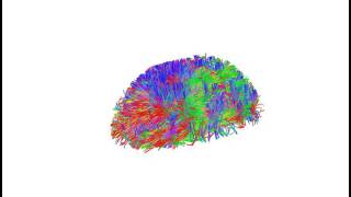 DSI Brain Scan 2017 DSI Brain Scan 2017
