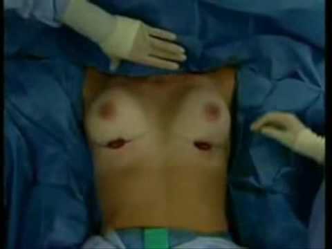 A menina mostrou o pequeno peito