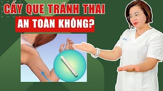 Cấy Que Tránh Thai An Toàn Không? Bác Sĩ Hạnh