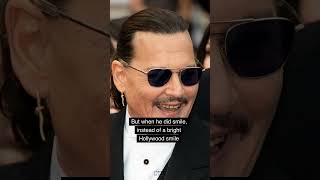 Johnny Depps Yellowed Teeth Shock Fans Its Really Bad