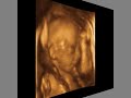 ultrasound 3d 4d