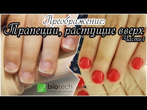 Трапециевидные ногти как исправить Трапециевидные ногти как исправить