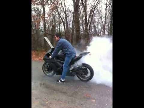 Burn Degrees Explained