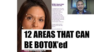 12 Areas on the Face that can be Botox'ed! - by Happy Clinic's Botox Buyer's Guide