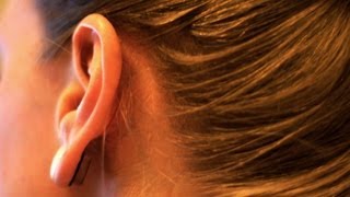 Natural Way To Deal With Ear Ringing Natural Way To Deal With Ear Ringing
