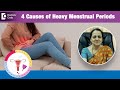 4 Causes of Heavy Menstrual Periods with Clots | Menorrhagia - Dr.H S Chandrika | Doctors' Circle