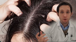 ¿Te pica la cabeza? Mira este vídeo.