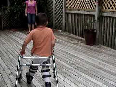 randall polio stance control leg brace polio stance control leg brace