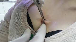 Nipple Göğüs Arası Piercing Delimi