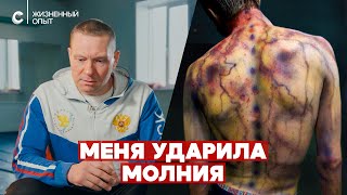 «Был Вход Через Голову, Выход Через Ногу». Пережил Удар Молнии