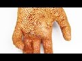 TRYPOPHOBIA PEANUT BUTTER HAND! | QUEENKINGSFX