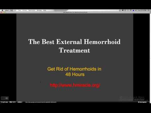 33 hemorrhoids symptom and treatment 47