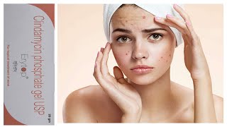 Erytop Gel Clindamycin 1% Ww पमपल, कल, महस क समसय क ठक कर