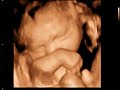 3D Ultrasound video clip: Baby of Reid Carolyn