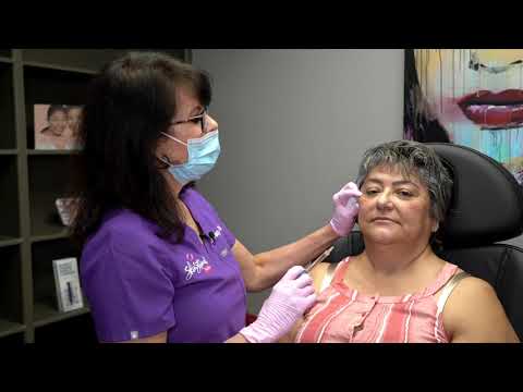 El Paso, TX | Cheek Filler Treatment | SkinSational MedSpa