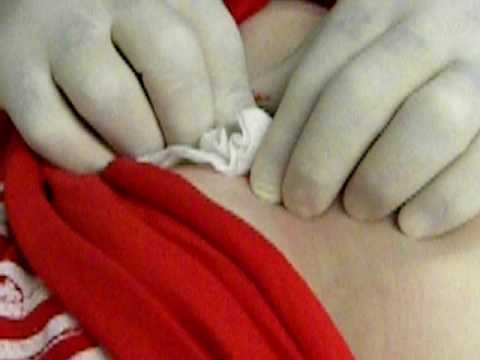 My chest / sternum dermal anchor piercings. Woohoo. My chest / sternum dermal anchor piercings. Woohoo.