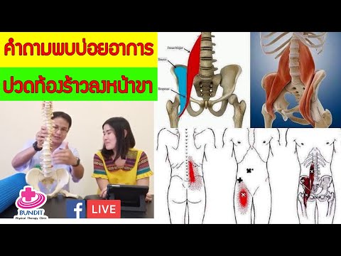 คำถามพบบ่อยอาการปวดช่องท้องร้าวลงหน้าขา ปวดกล้ามเนื้อกลุ่มงอสะโพก #Iliopsoas