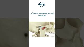 Yemek Yerken Çene Ağrısı Yaşıyorsanız Dikkat