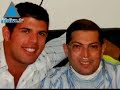 First Israeli live-donor lung transplant patient dies
