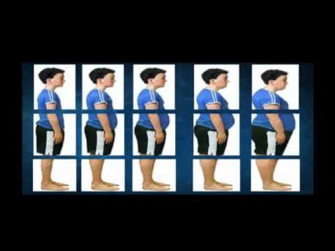 Obesidad Infantil. Alarma en Mexico.OMS - YouTube Obesidad Infantil. Alarma en Mexico.OMS - YouTube