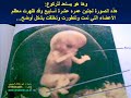 صلاة الجنين في بطن أمه بالصور