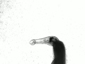 Schistosoma Mansoni - Symptoms Schistosoma Mansoni - Symptoms