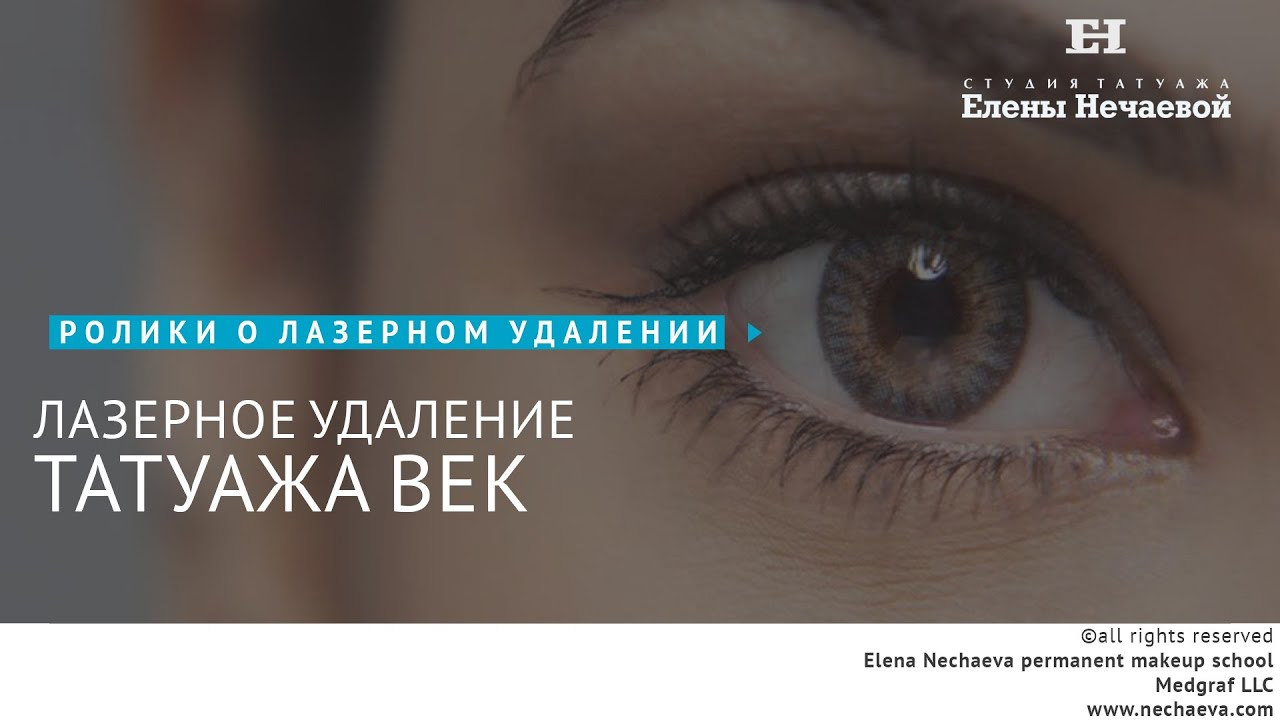 Удалить лазером перманентный макияж век Удалить лазером перманентный макияж век