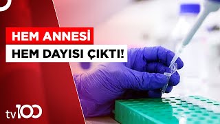 Tıp Dünyasını Şaşırtan Dna Testi Sonucu Tv100 Haber
