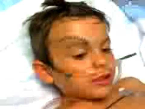 5 YR OLD GETS 26 STITCHES IN HEAD 