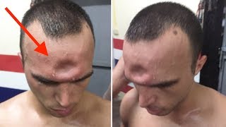 When Muay Thai Goes Wrong