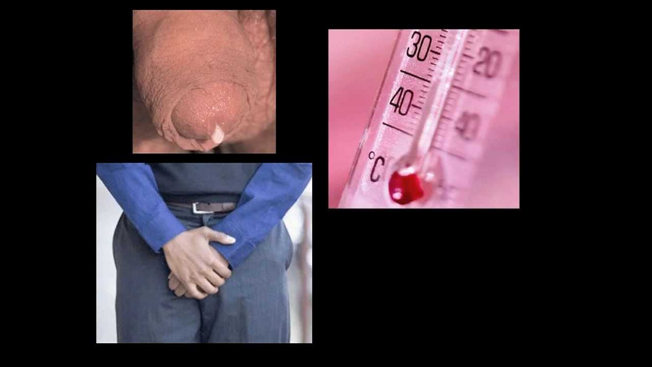 Al niño en 11 años el pequeño pene