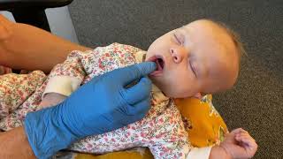 Infant Tongue Elevation Exercise Part 2: Optimal Tongue Rest Position
