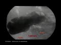 image Upper Gi Movies Tonic Contract Of Cae Causes Mix In Pig