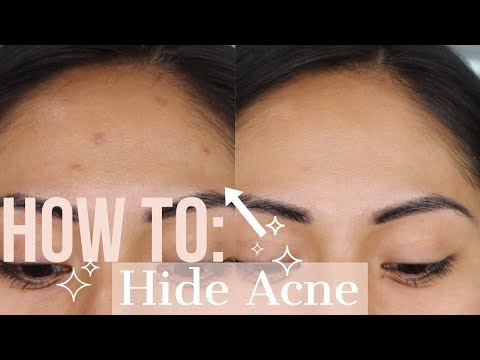 How To Hide Acne With Concealer | Easy How To Hide Acne or Acne Scars - YouTube