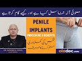 Nafs Ki Kamzori Ka Ilaj - Penile Implant Procedure & Benefits - Azu Tanasul Ka Thik Karne Ka Tarika