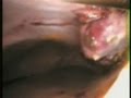 discovering strange animal in abdomen woman.دكتور علاء رفاعى