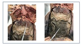 Rabbit Dissection Video Lecture