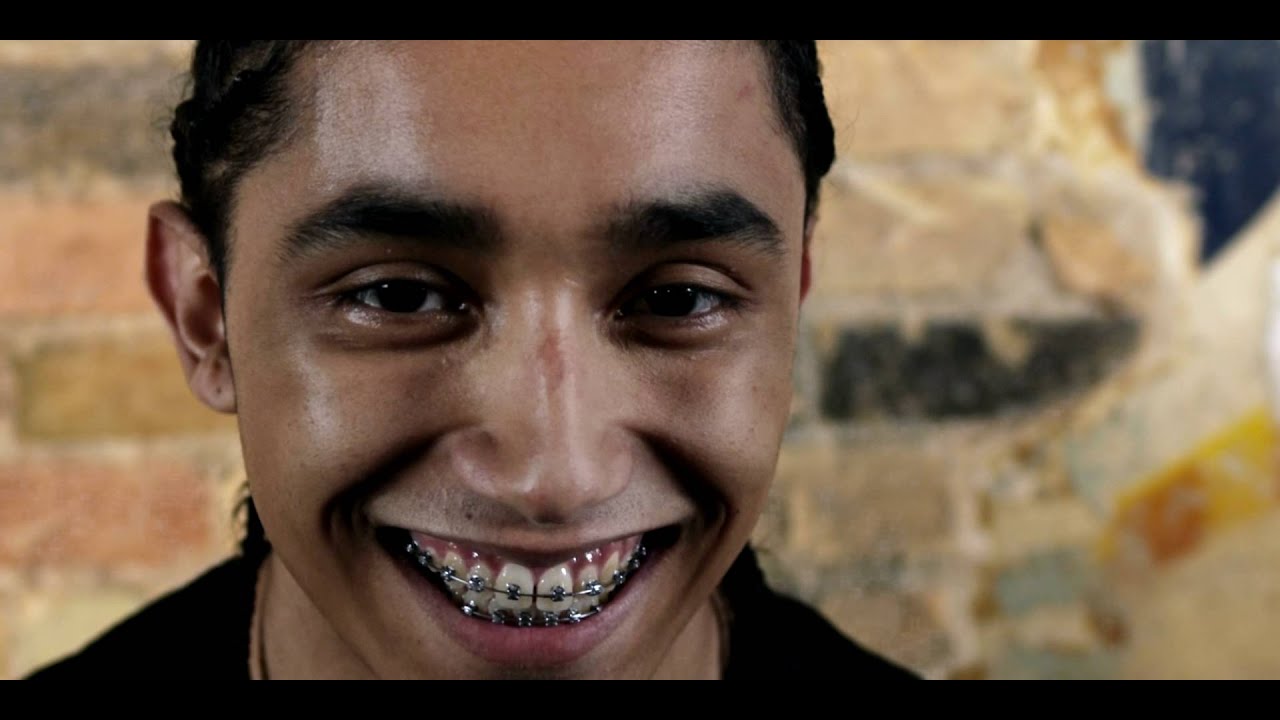 Braces man The cost of braces can vary depending on the type of braces, where you buy your braces, and required procedures for fitting. Find out about braces at pc-ios.tk The cost of braces can vary depending on the type of braces, where you buy your braces, and required procedures for fitting. Find out about braces at pc-ios.tk
