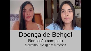 Luisa - Doença de Behçet