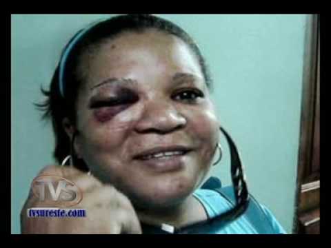 FOTOS DE MUJERES GOLPEADAS fotos de mujeres golpeadas: