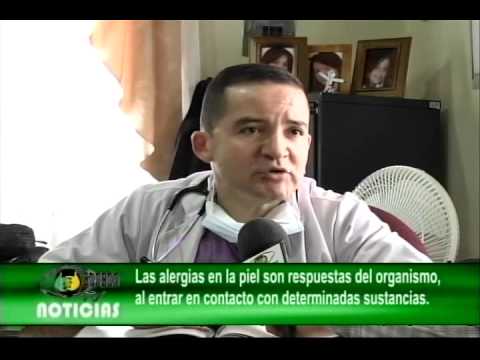 La psoriasis de la parte pilosa de la cabeza el tratamiento la cebolla