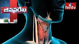 Thyroid Symptoms And Treatment | Homeocare International | Jeevan Rekha | Health News | hmtv